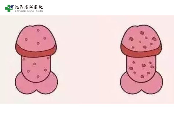 热点更新：沈阳省城男科“专业医院”-沈阳男科医院哪家好？